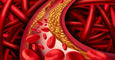 Status of lipid control in Bangladeshi subjects with type 2 diabetes mellitus on lipid-lowering drugs: a multicenter, facility-based, cross-sectional study